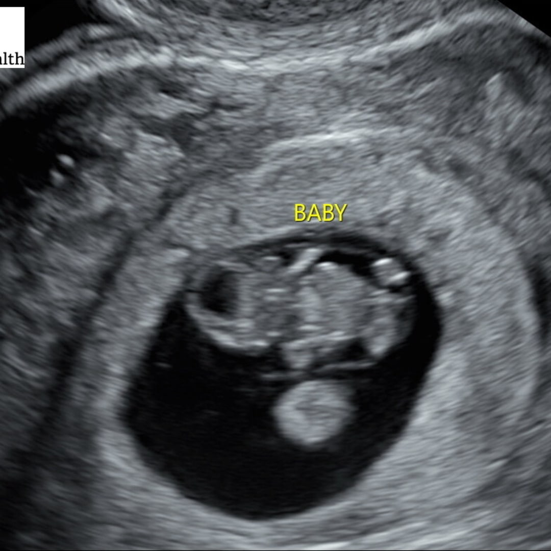 Photo shared by Maya for their Babylist baby registry.