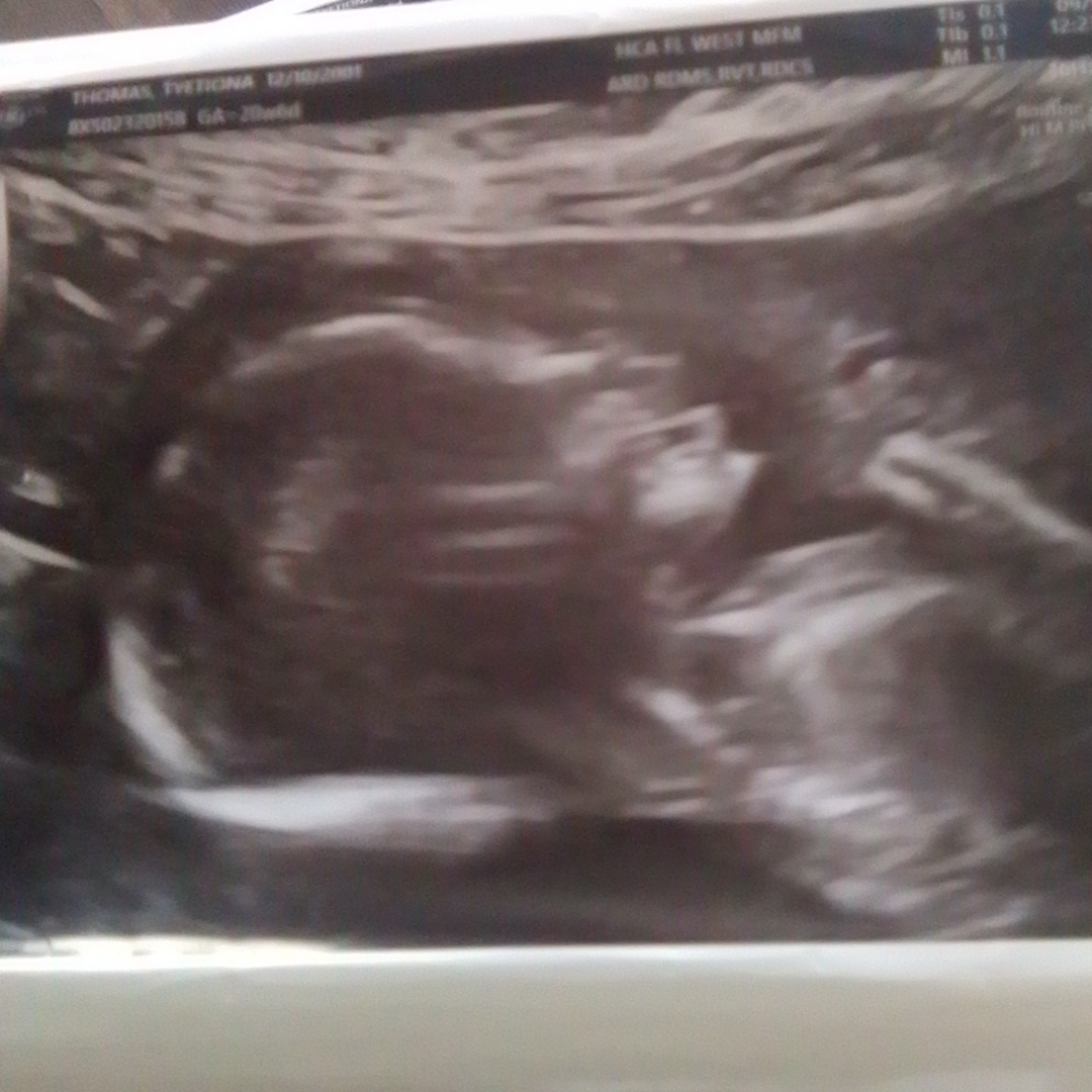 Photo shared by Tyetiona for their Babylist baby registry.