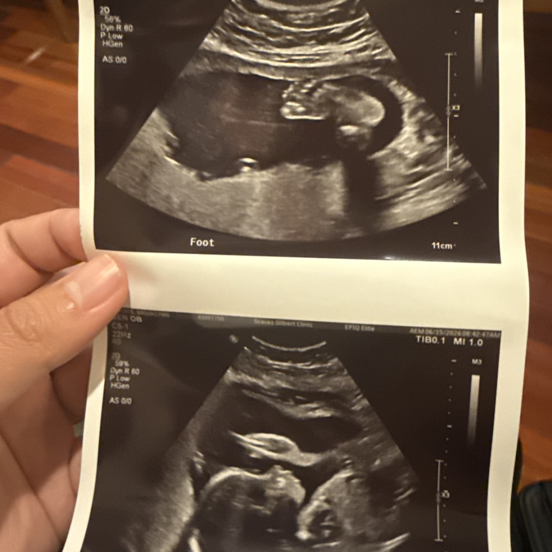 Photo shared by Brooklynn for their Babylist baby registry.