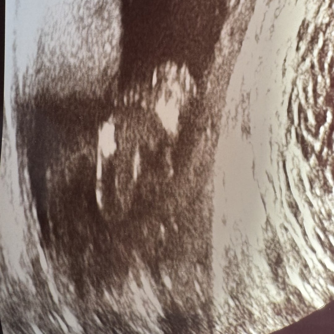 Photo shared by Marissa for their Babylist baby registry.