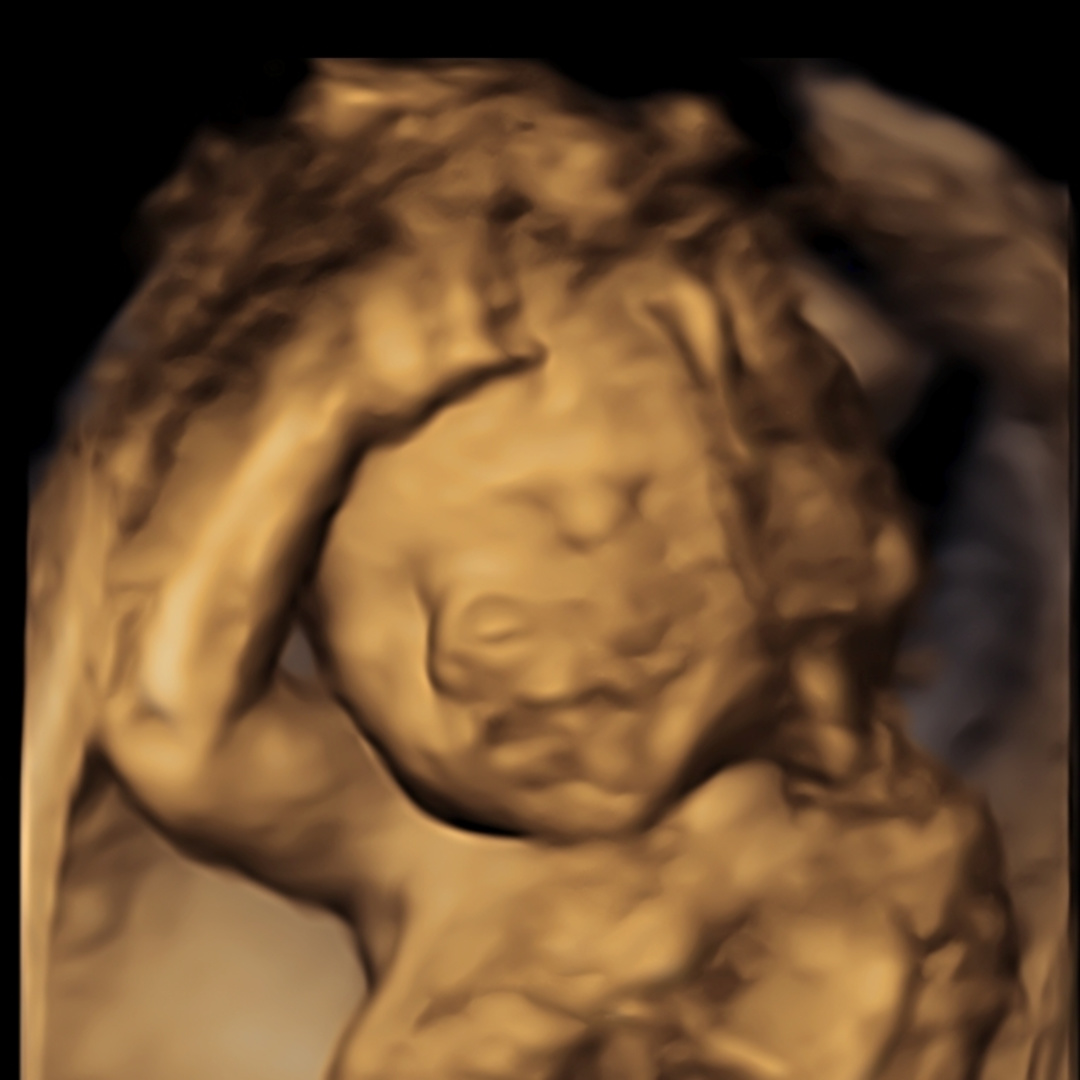 Photo shared by Alanna for their Babylist baby registry.