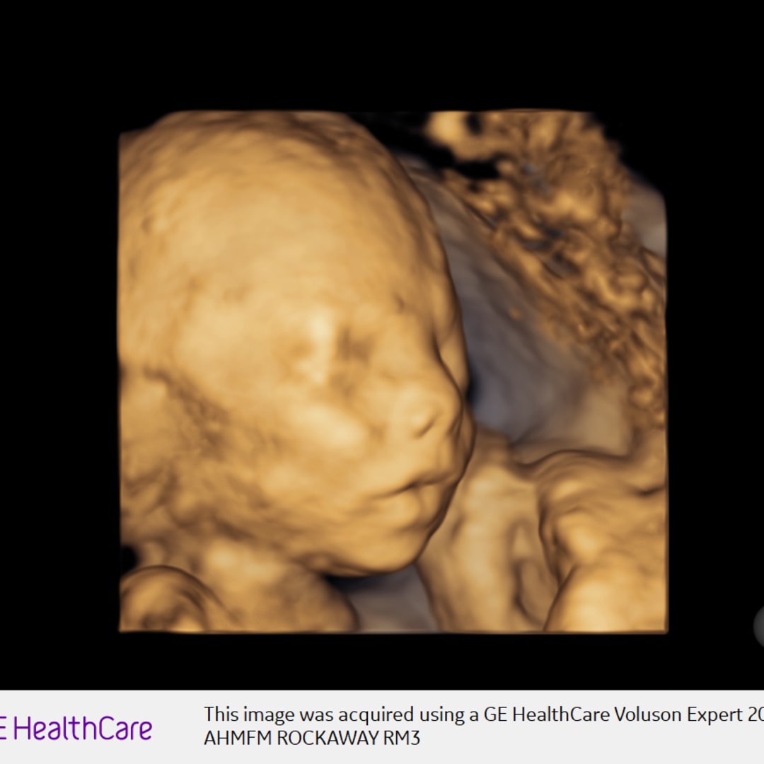 Photo shared by Elexa for their Babylist baby registry.