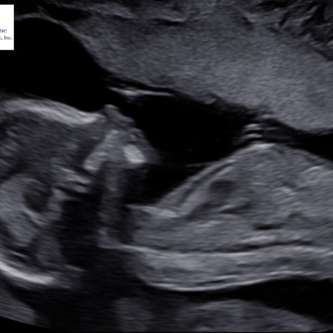 Photo shared by Amber for their Babylist baby registry.