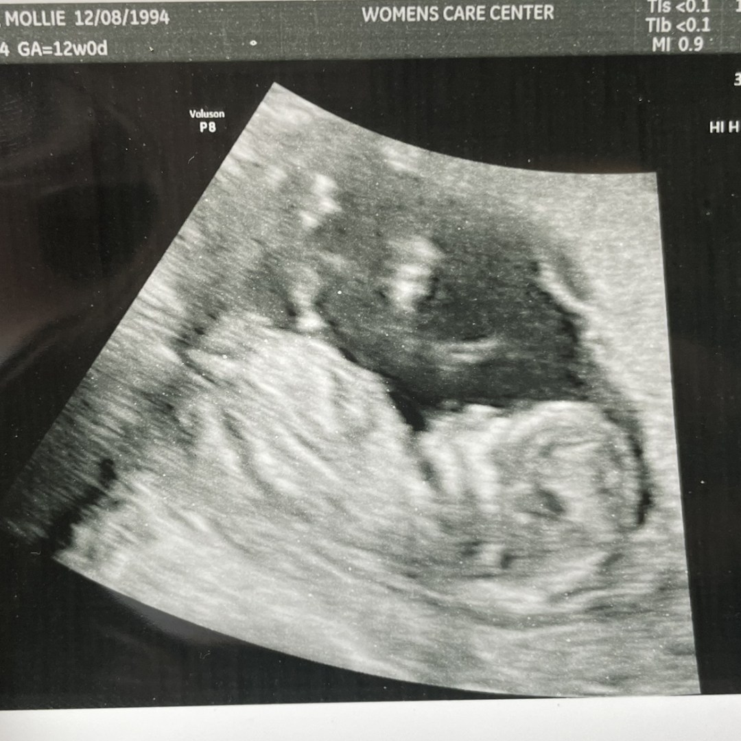 Photo shared by Mollie for their Babylist baby registry.