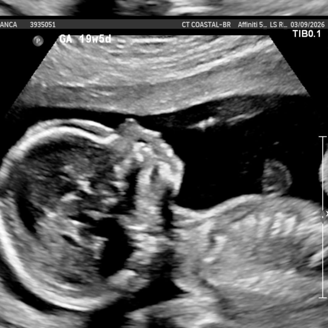 Photo shared by Bianca for their Babylist baby registry.