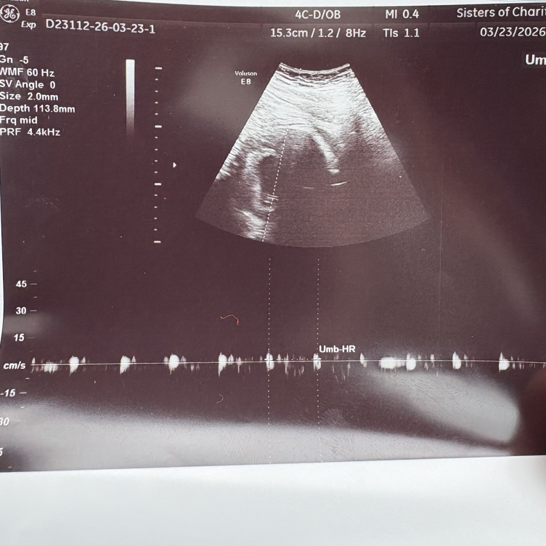 Photo shared by Aaliyah for their Babylist baby registry.