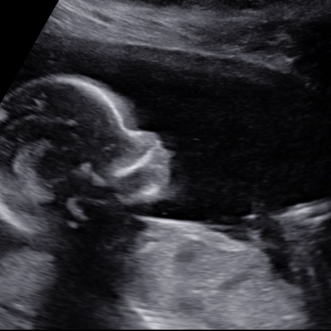 Photo shared by Giovanna for their Babylist baby registry.