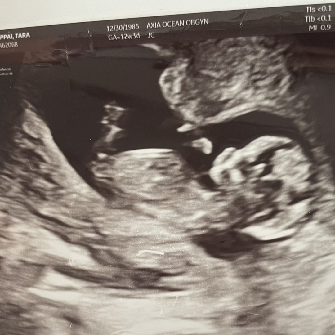 Photo shared by Tara for their Babylist baby registry.