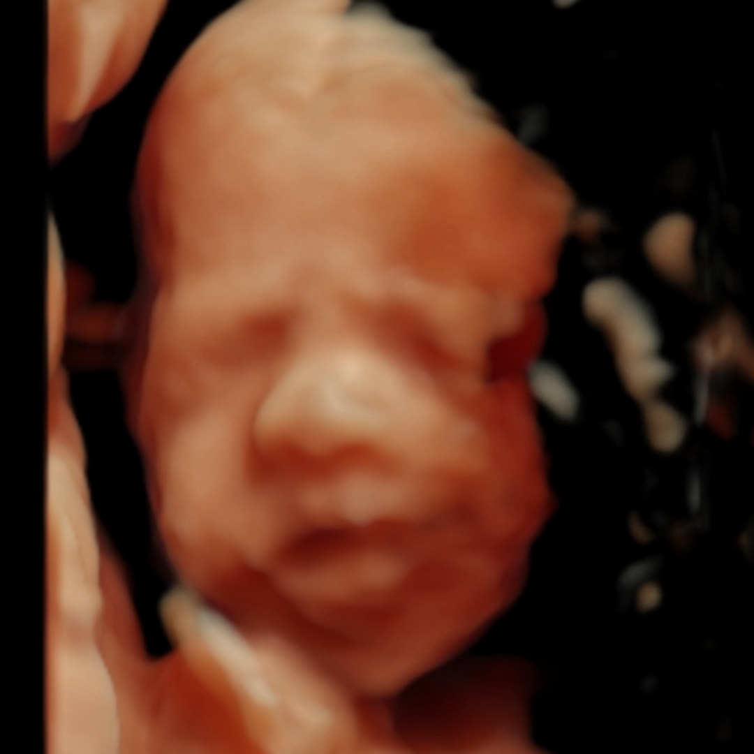 Photo shared by Victoria for their Babylist baby registry.