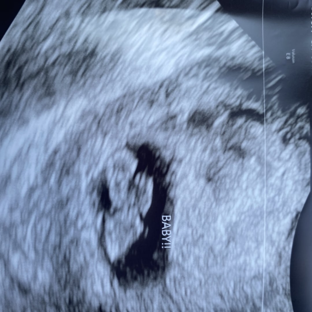 Photo shared by Rachel for their Babylist baby registry.