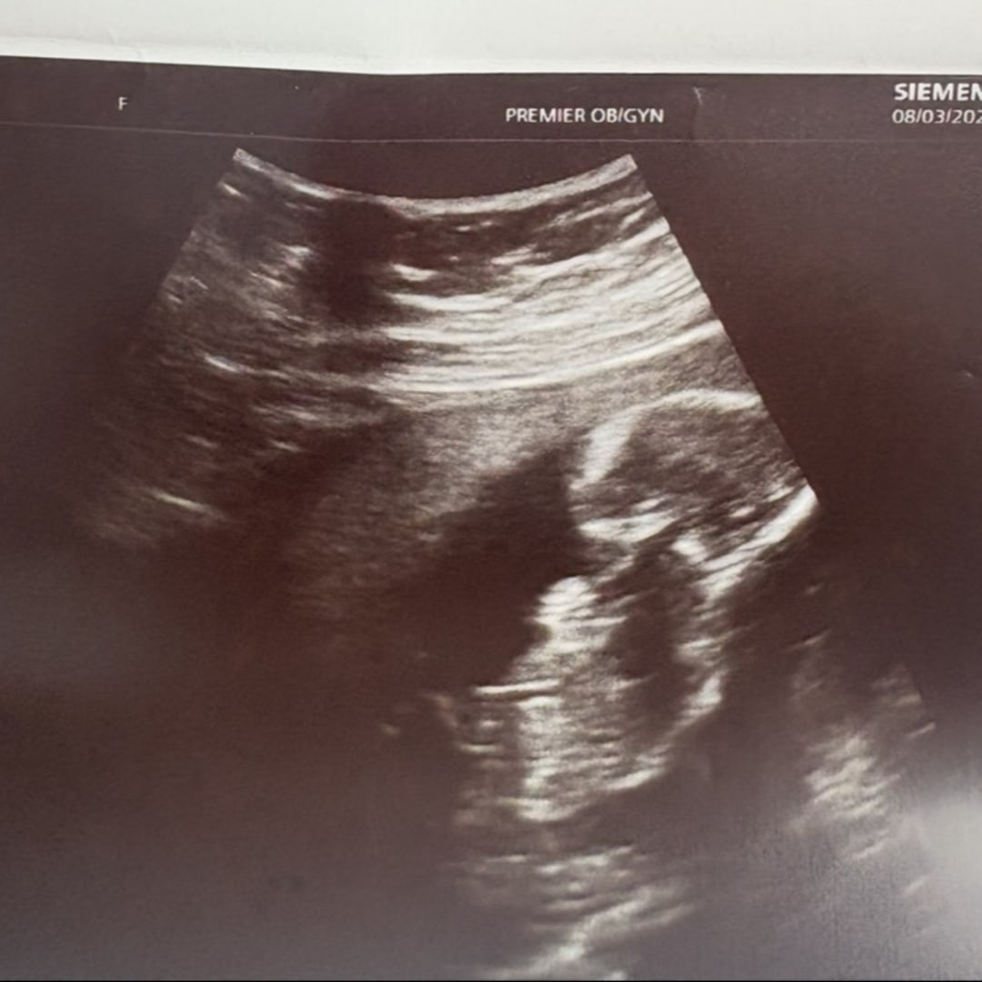 Photo shared by Elizabeth for their Babylist baby registry.