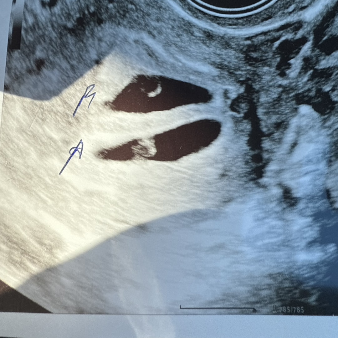 Photo shared by Paige for their Babylist baby registry.