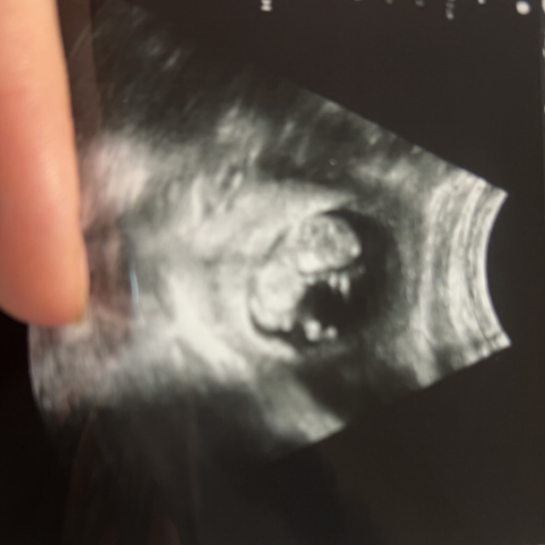 Photo shared by Kaitlyn for their Babylist baby registry.
