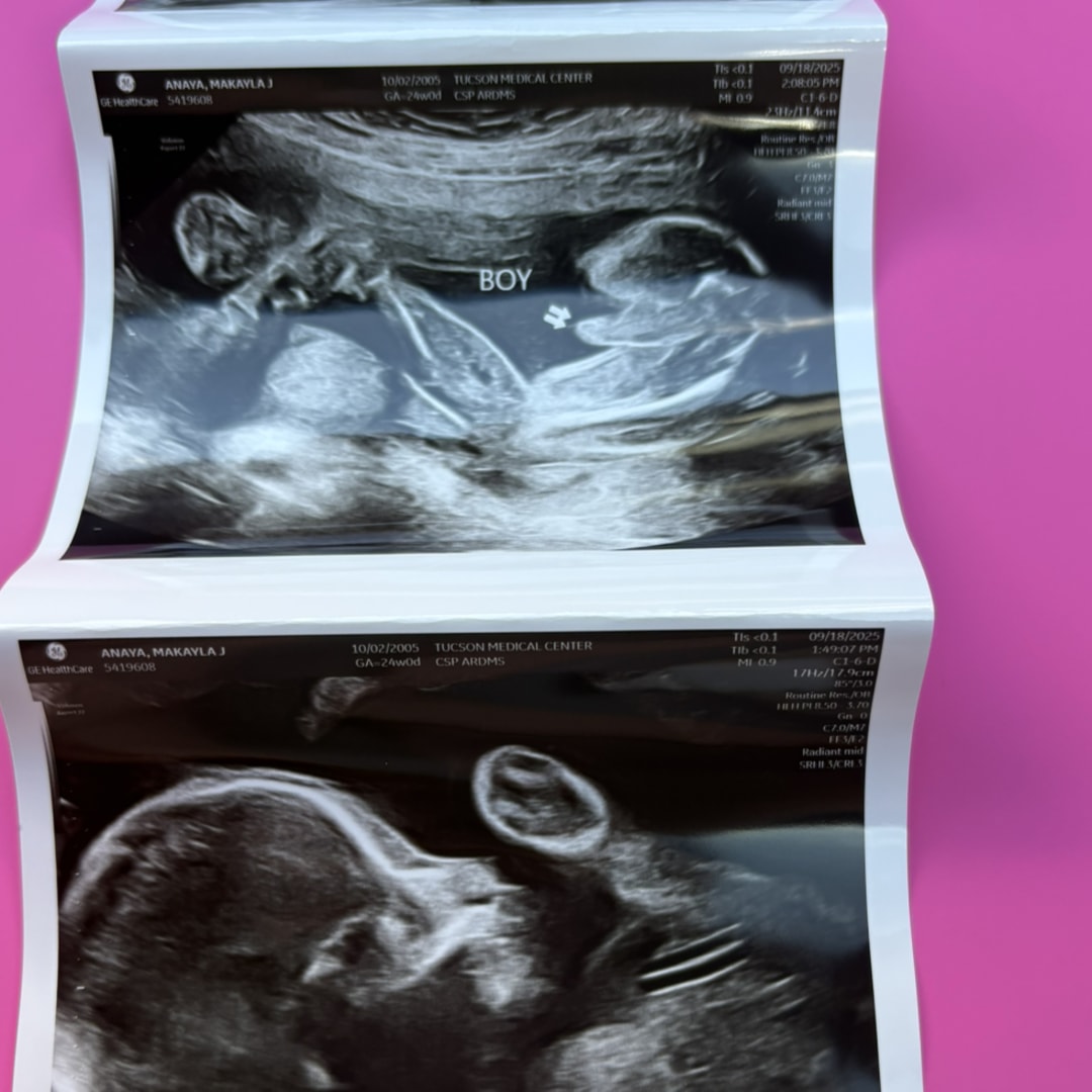 Photo shared by Makayla for their Babylist baby registry.