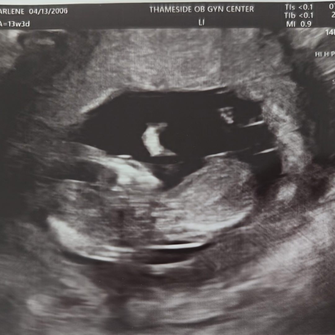 Photo shared by Darlene for their Babylist baby registry.