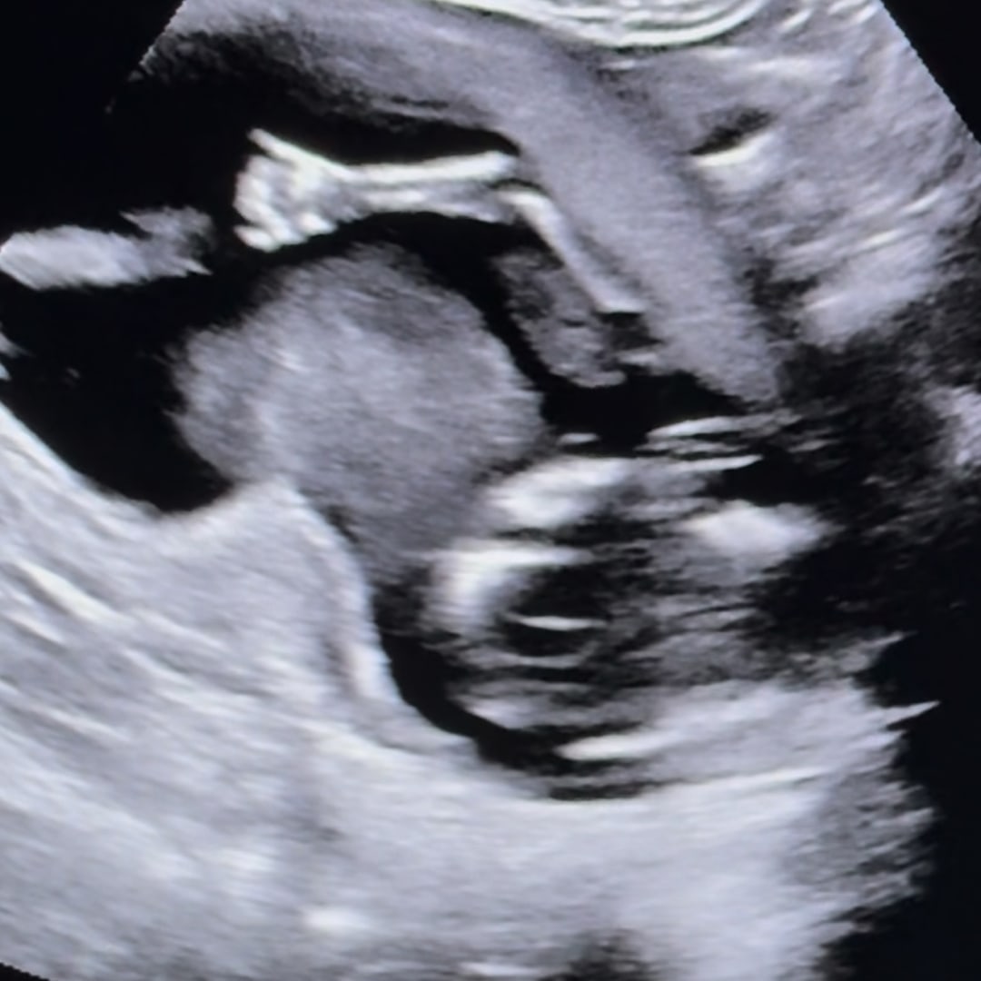 Photo shared by Halle for their Babylist baby registry.