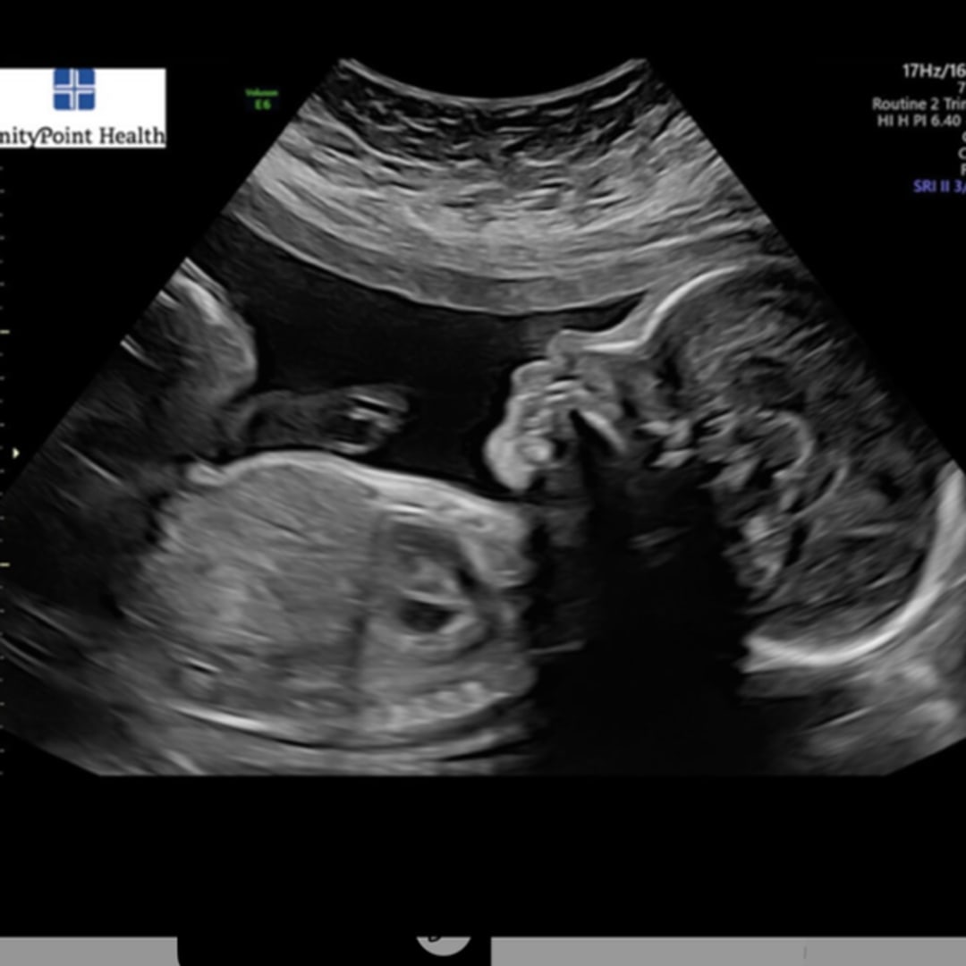 Photo shared by Ceiry for their Babylist baby registry.