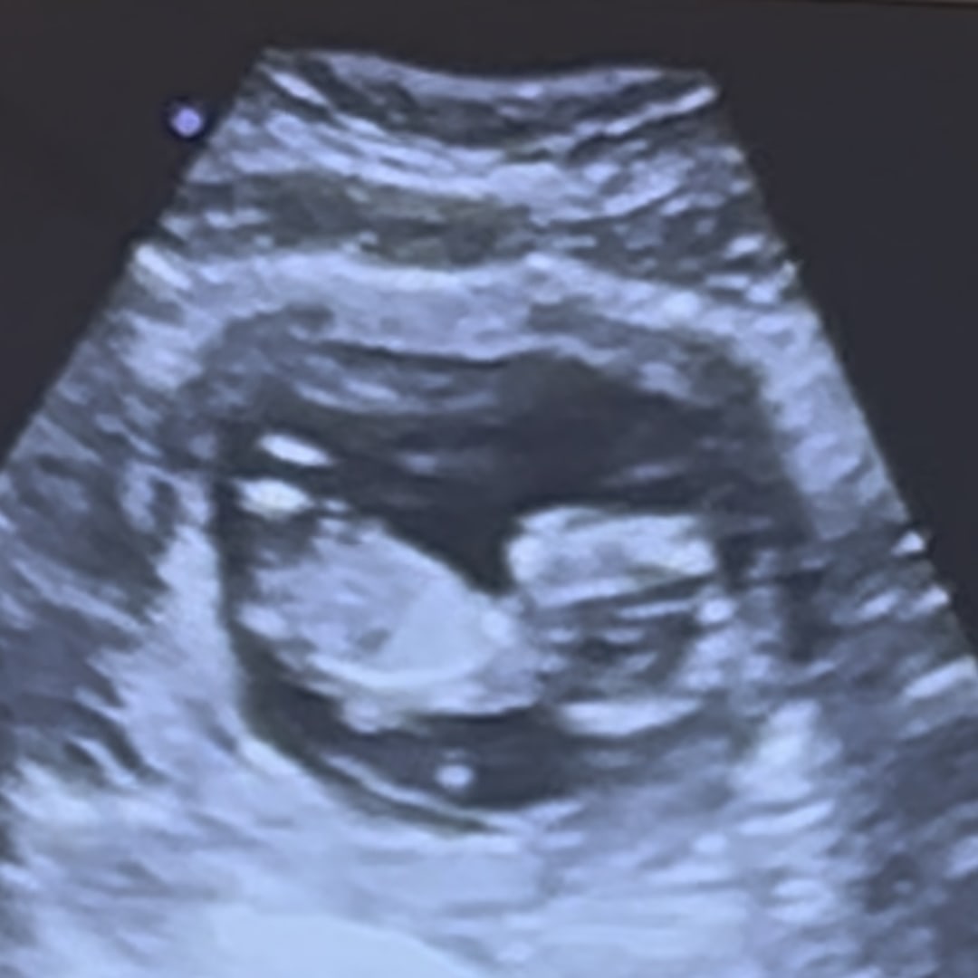 Photo shared by Bethany for their Babylist baby registry.