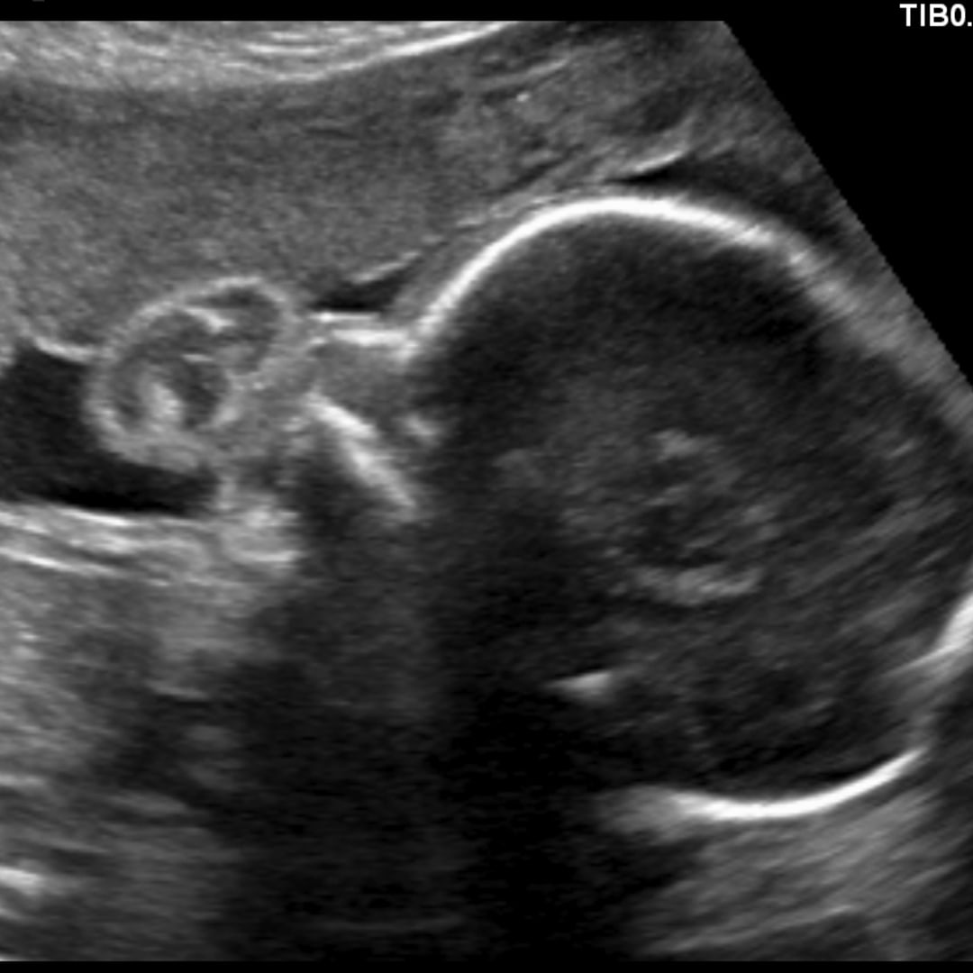 Photo shared by Cristy for their Babylist baby registry.