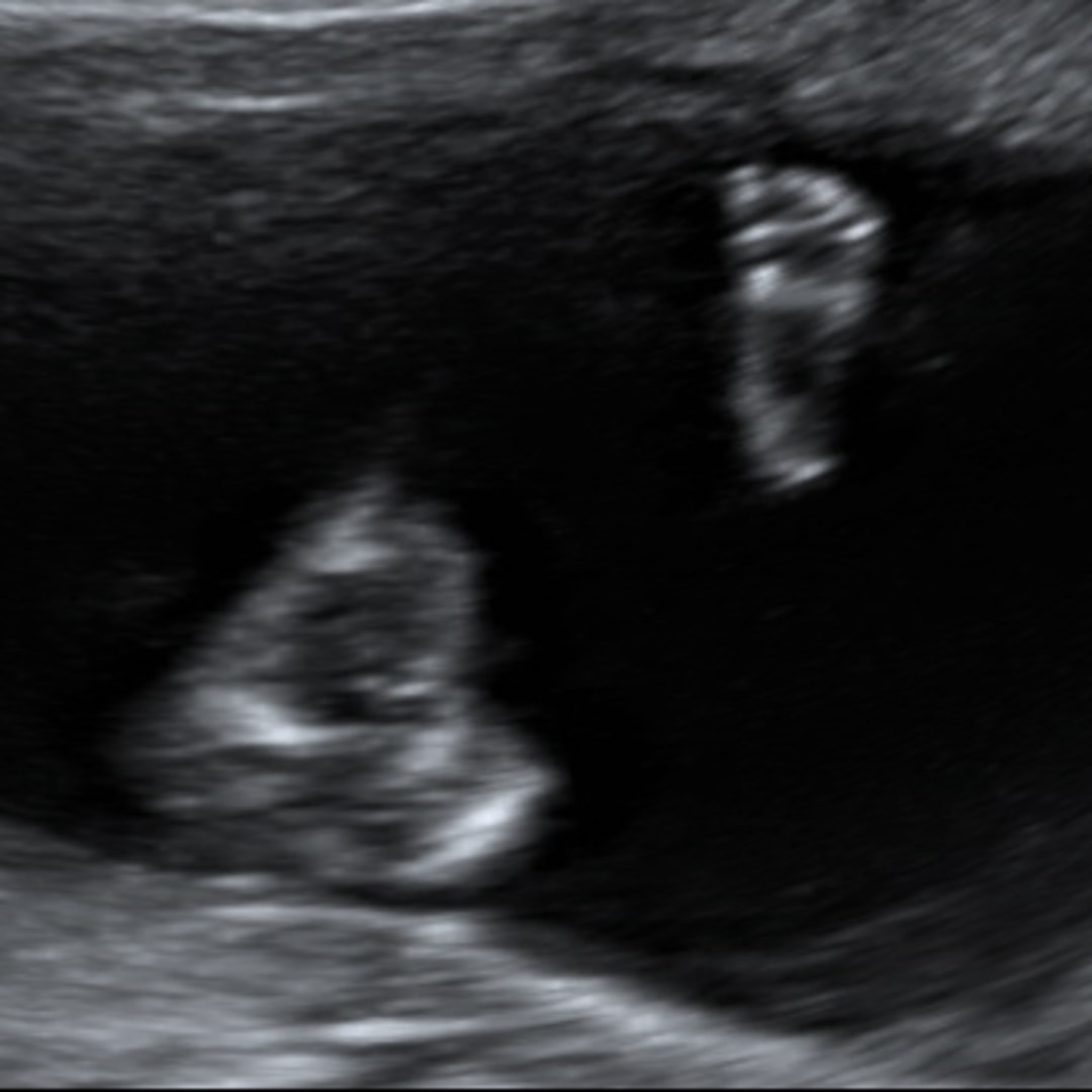 Photo shared by Ella for their Babylist baby registry.