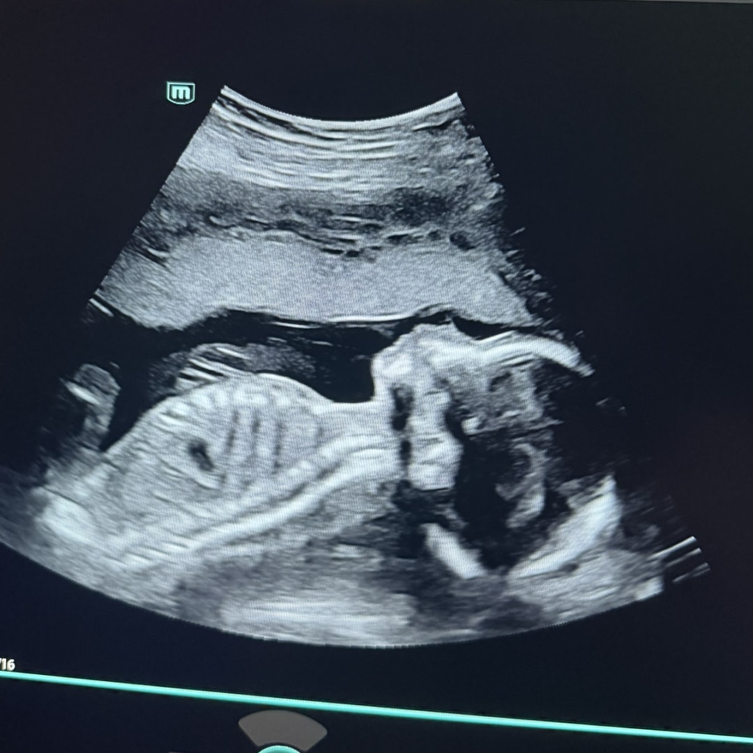 Photo shared by Peyton for their Babylist baby registry.