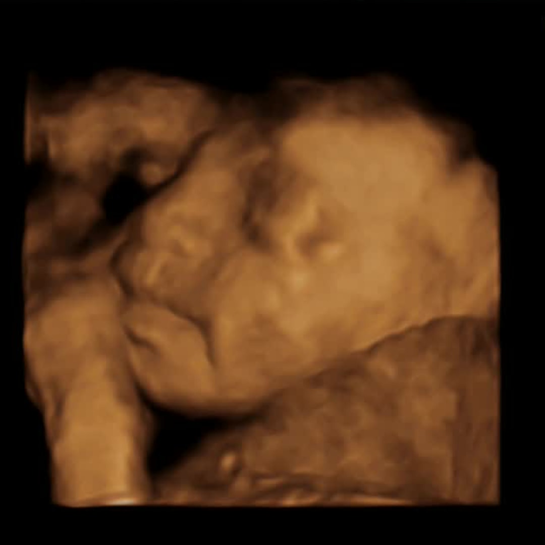 Photo shared by Kayla for their Babylist baby registry.