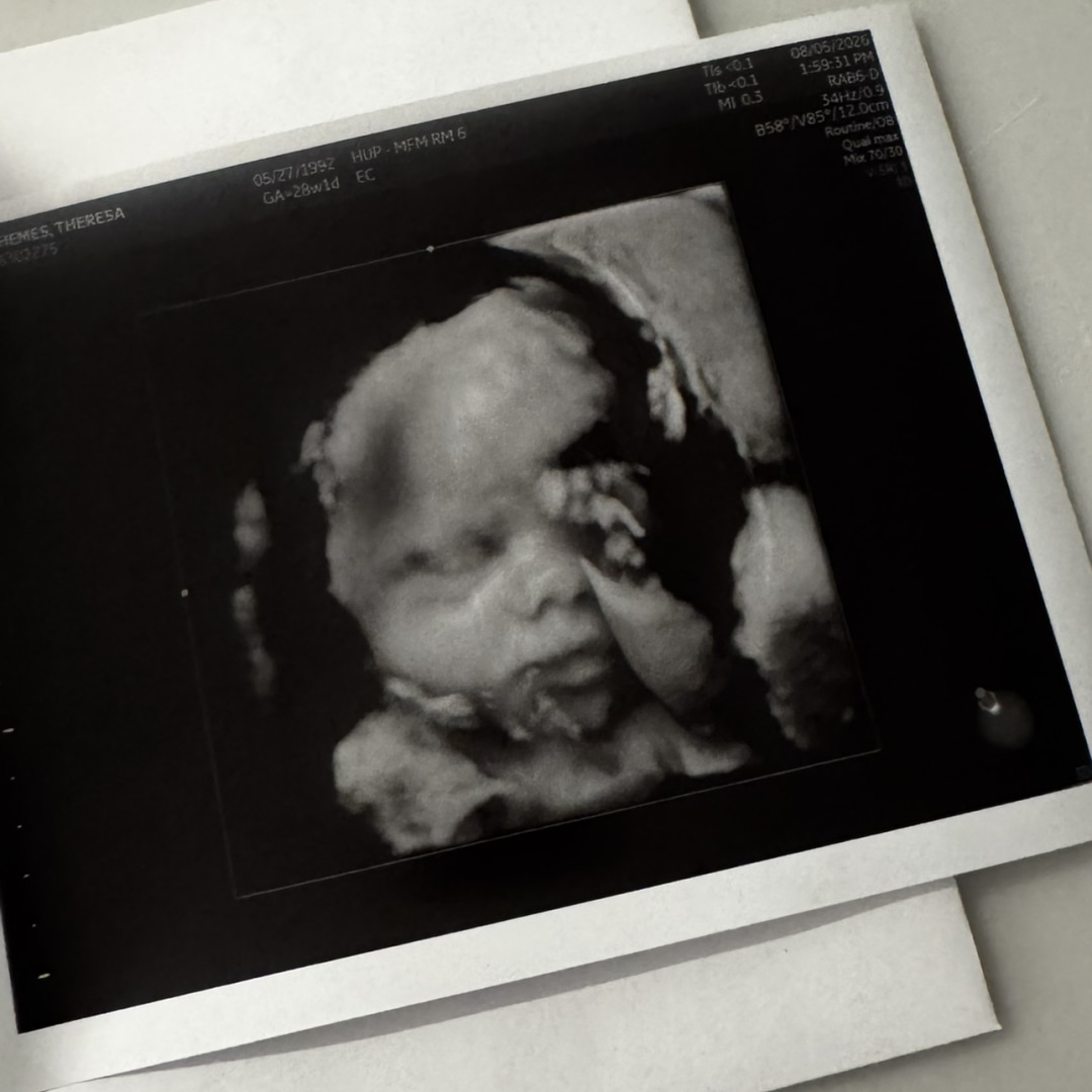 Photo shared by Theresa for their Babylist baby registry.