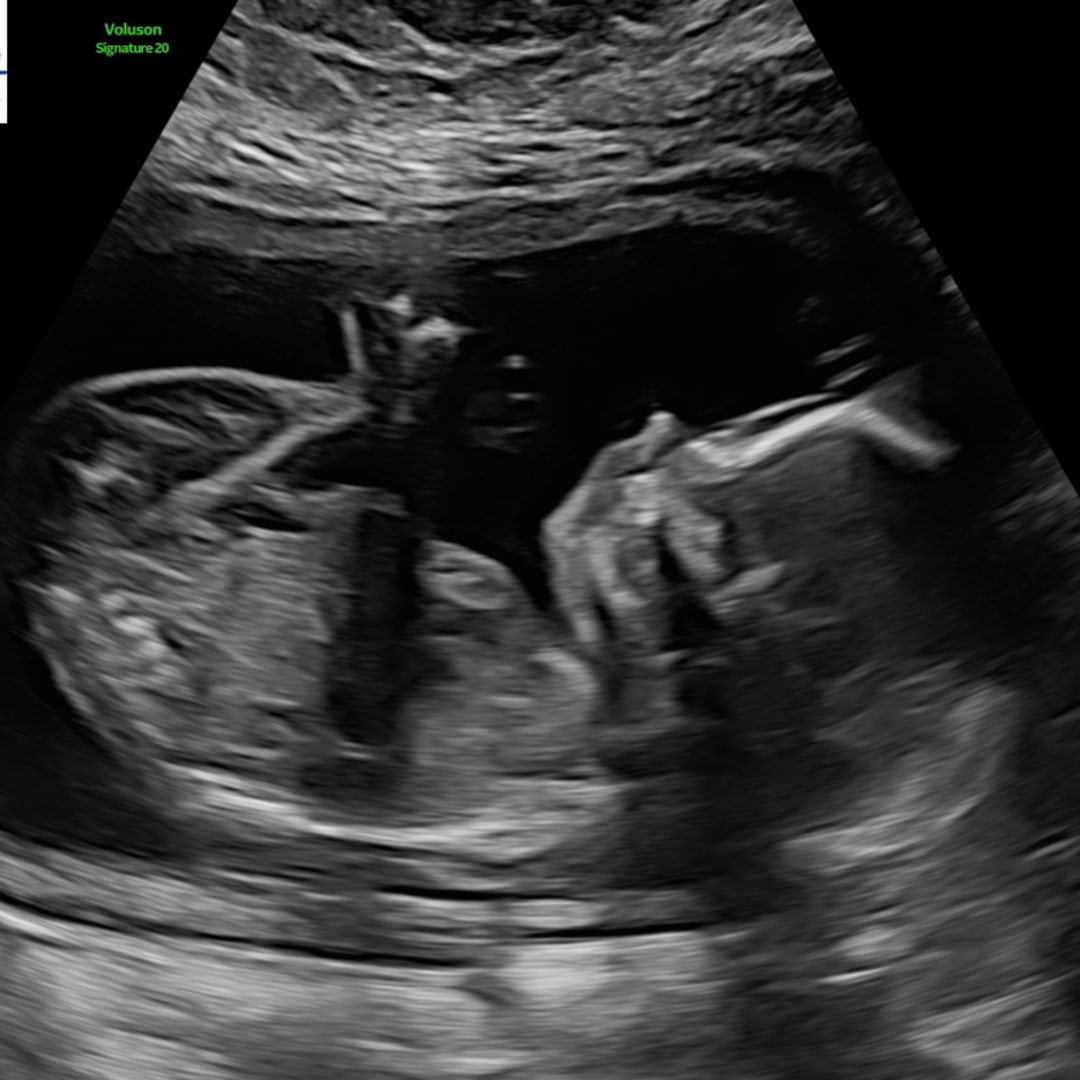 Photo shared by Lexie for their Babylist baby registry.