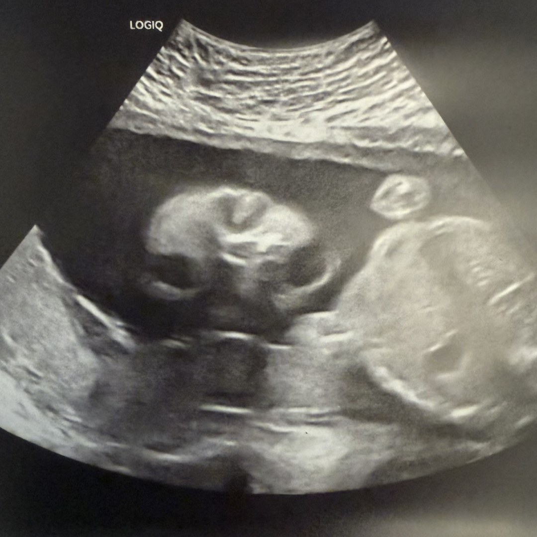 Photo shared by Olivia for their Babylist baby registry.