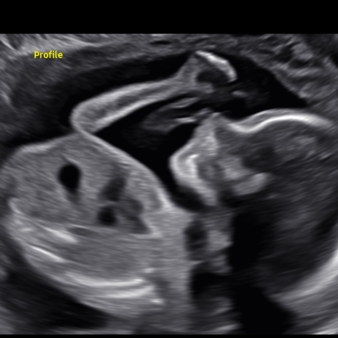 Photo shared by Alison for their Babylist baby registry.