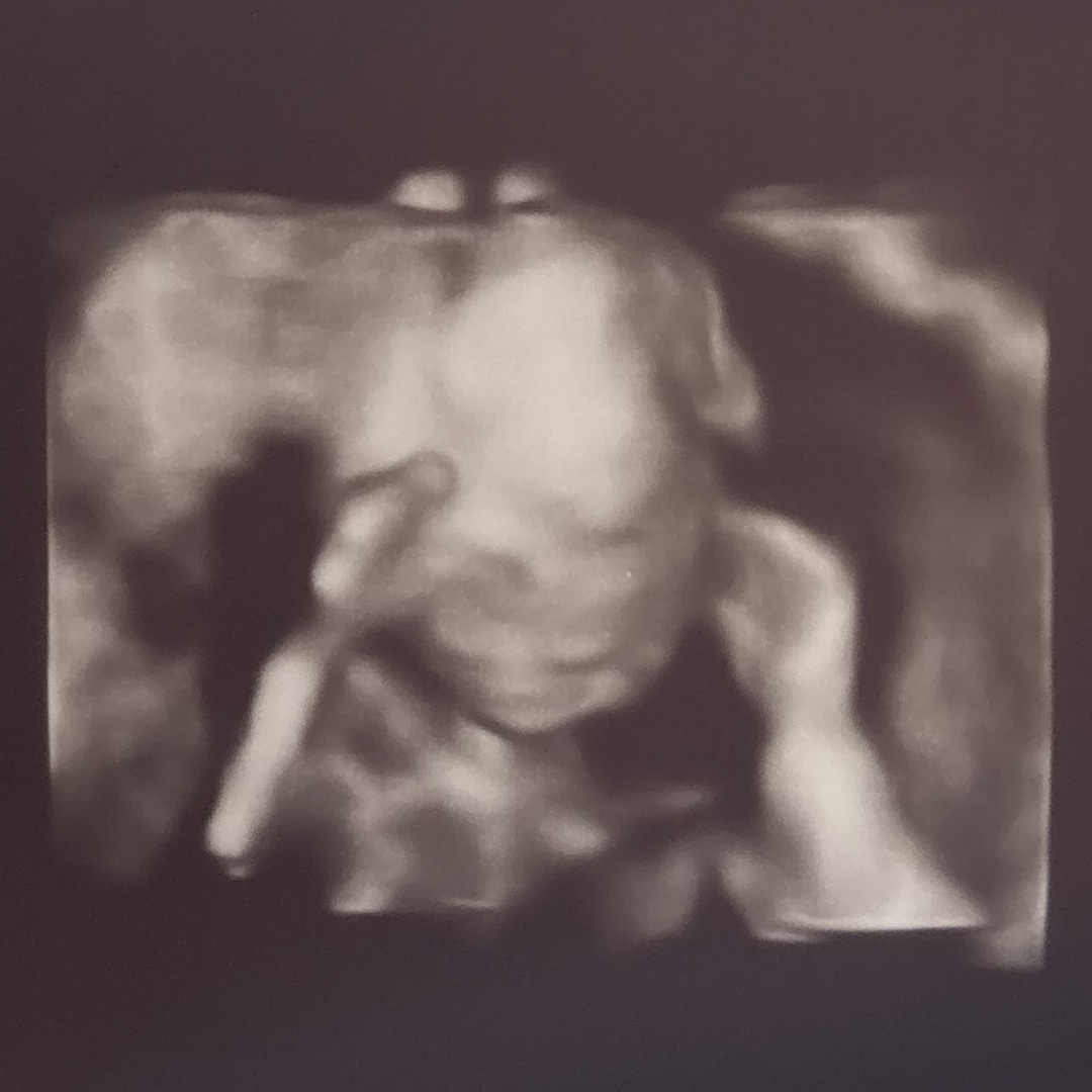 Photo shared by Allie for their Babylist baby registry.
