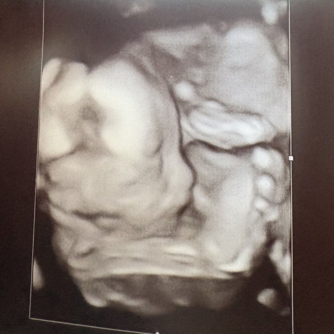 Photo shared by Kaylee for their Babylist baby registry.