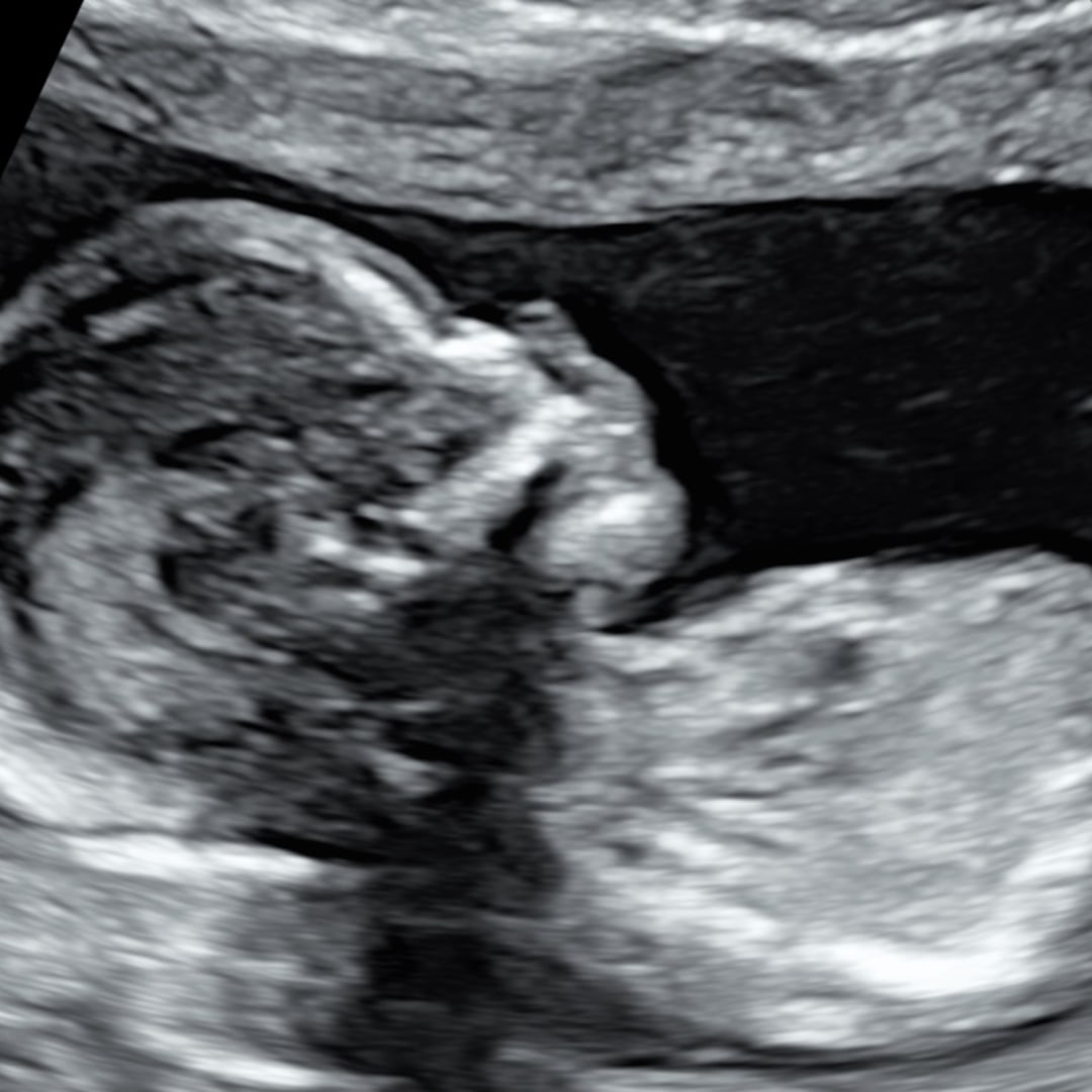 Photo shared by Chelsey for their Babylist baby registry.