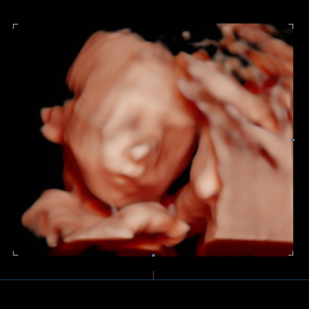 Photo shared by Sheyanne for their Babylist baby registry.