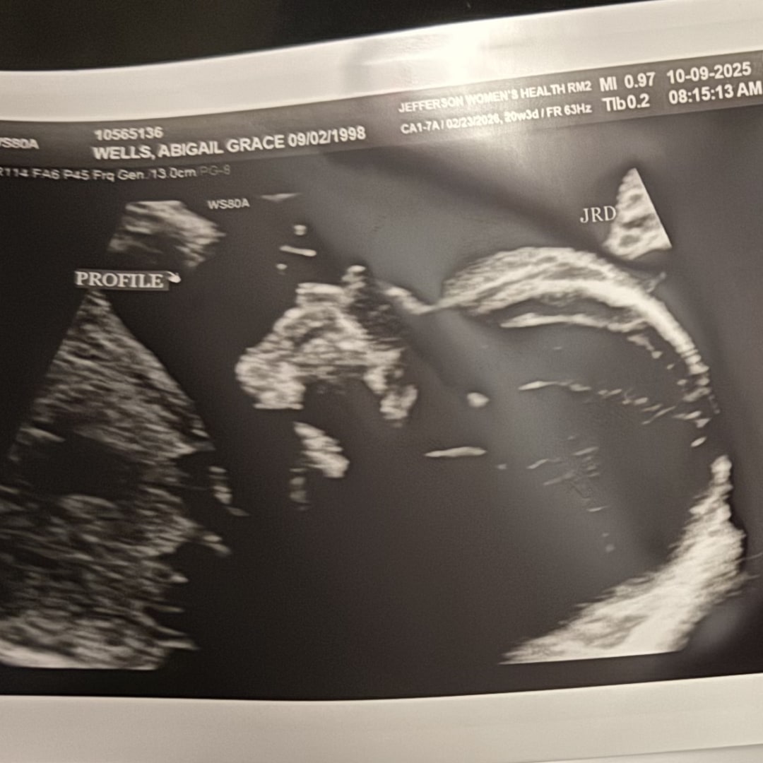 Photo shared by Abigail for their Babylist baby registry.