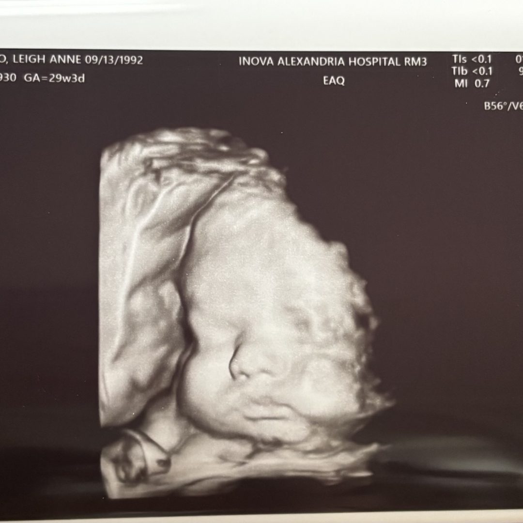 Photo shared by Leigh for their Babylist baby registry.