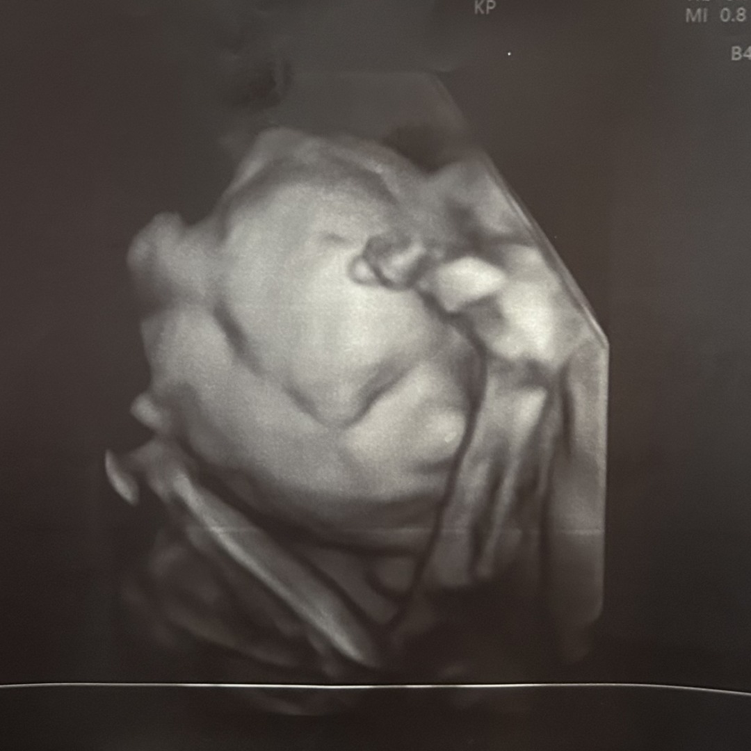 Photo shared by Allison for their Babylist baby registry.