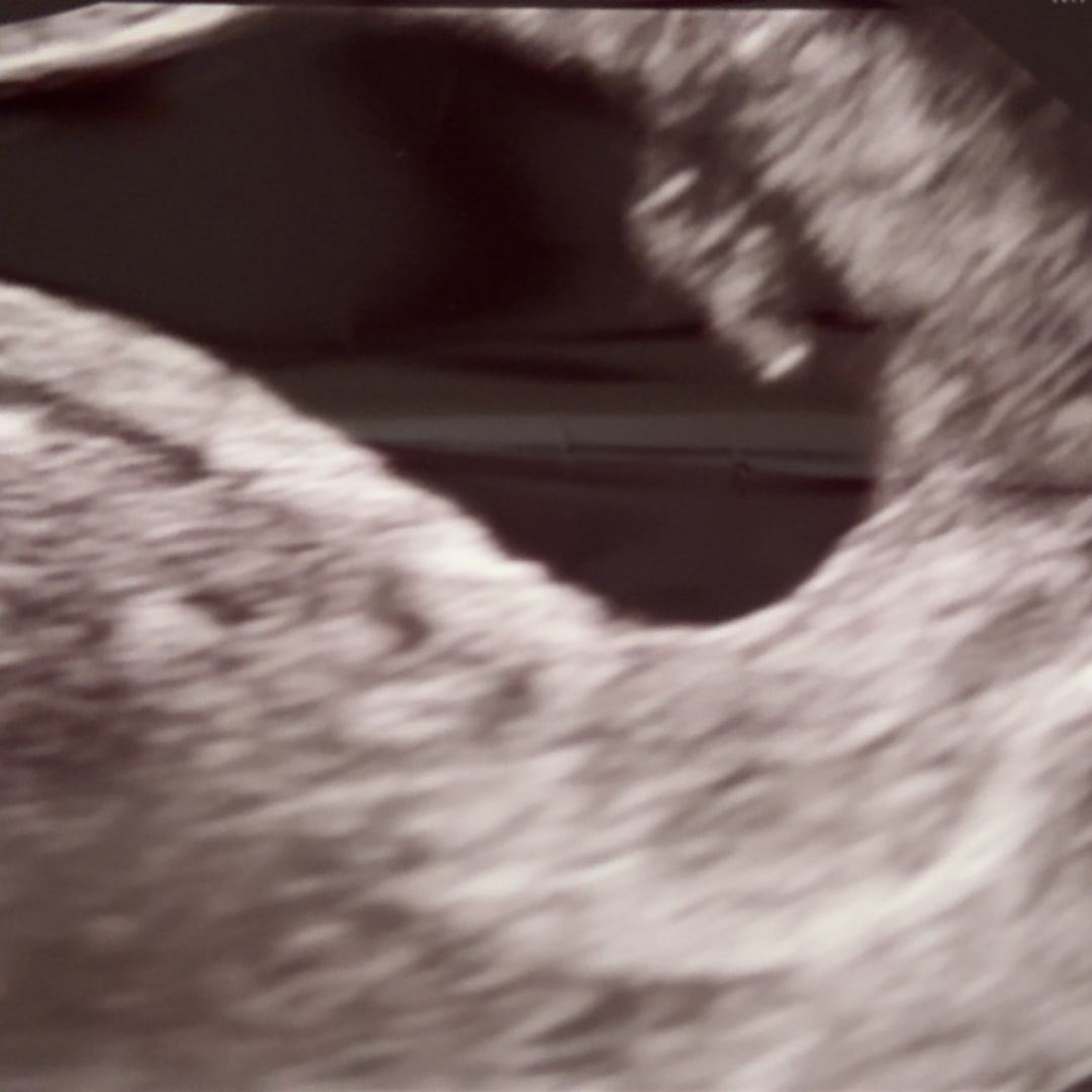 Photo shared by Kaylyn for their Babylist baby registry.