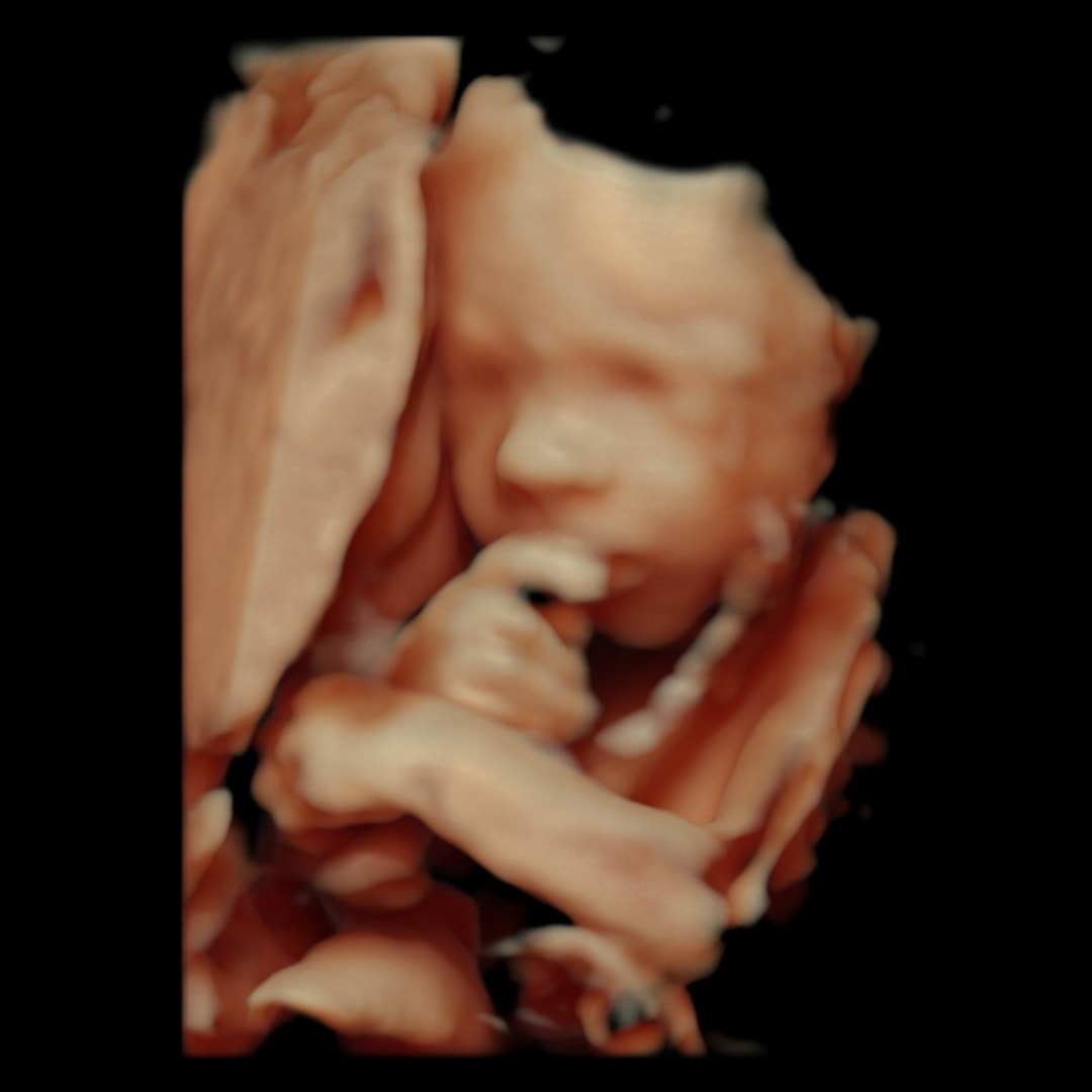 Photo shared by Baylie for their Babylist baby registry.