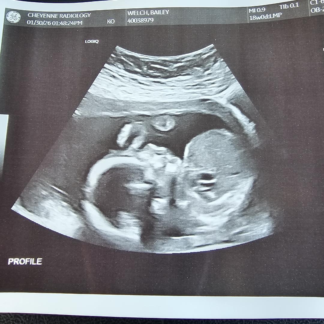 Photo shared by Bailey for their Babylist baby registry.