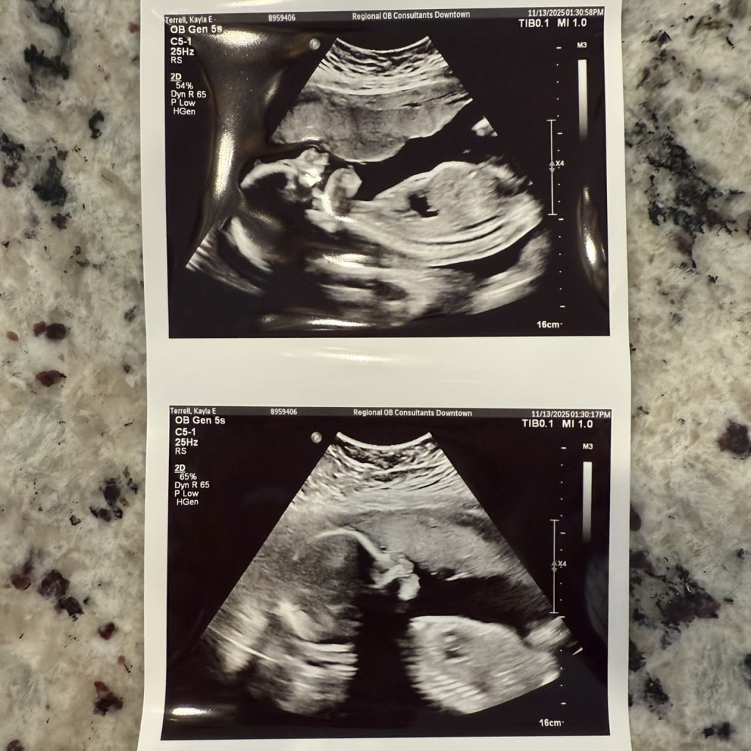 Photo shared by Kayla for their Babylist baby registry.