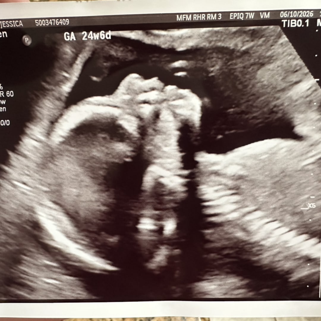 Photo shared by Jessica for their Babylist baby registry.