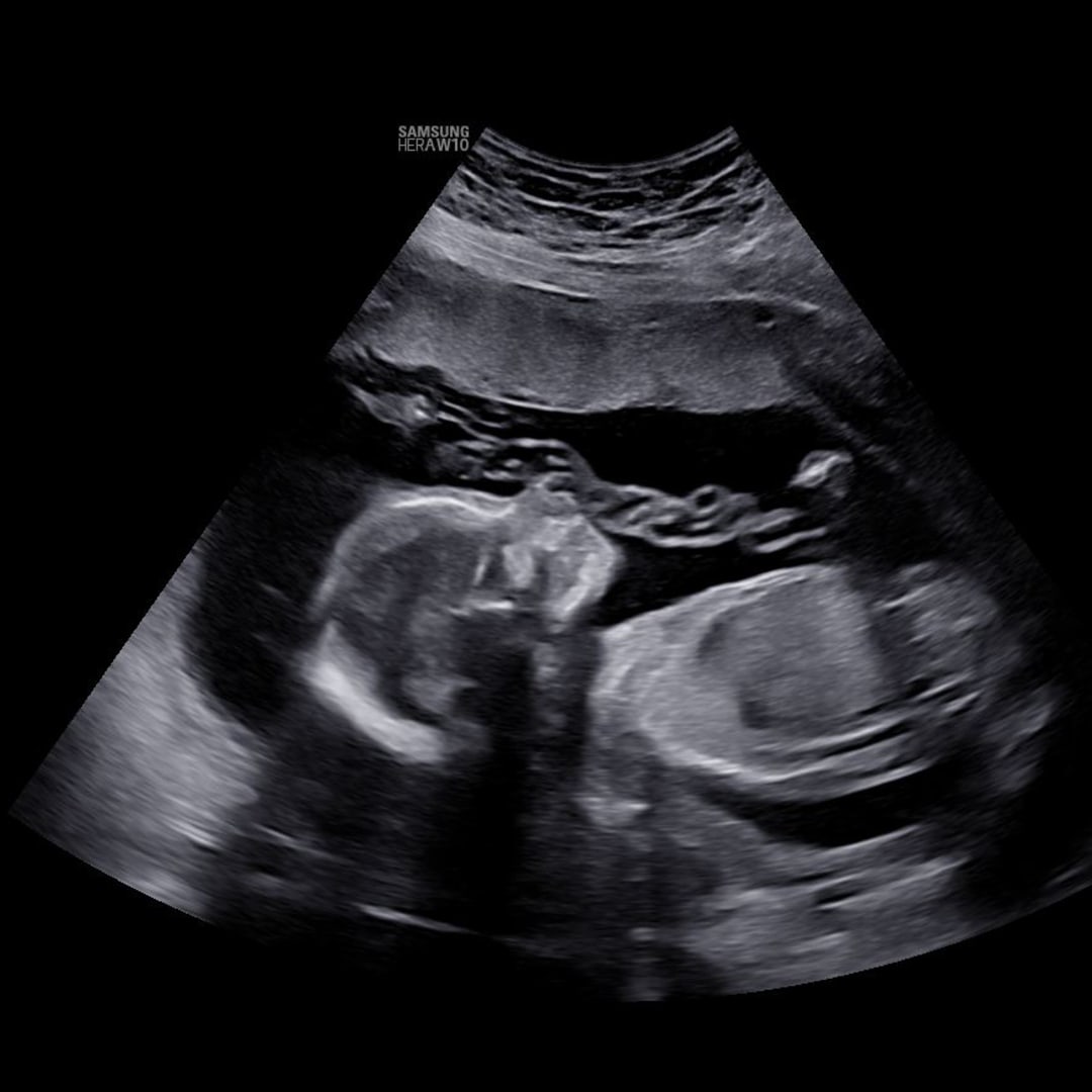 Photo shared by Sarah for their Babylist baby registry.