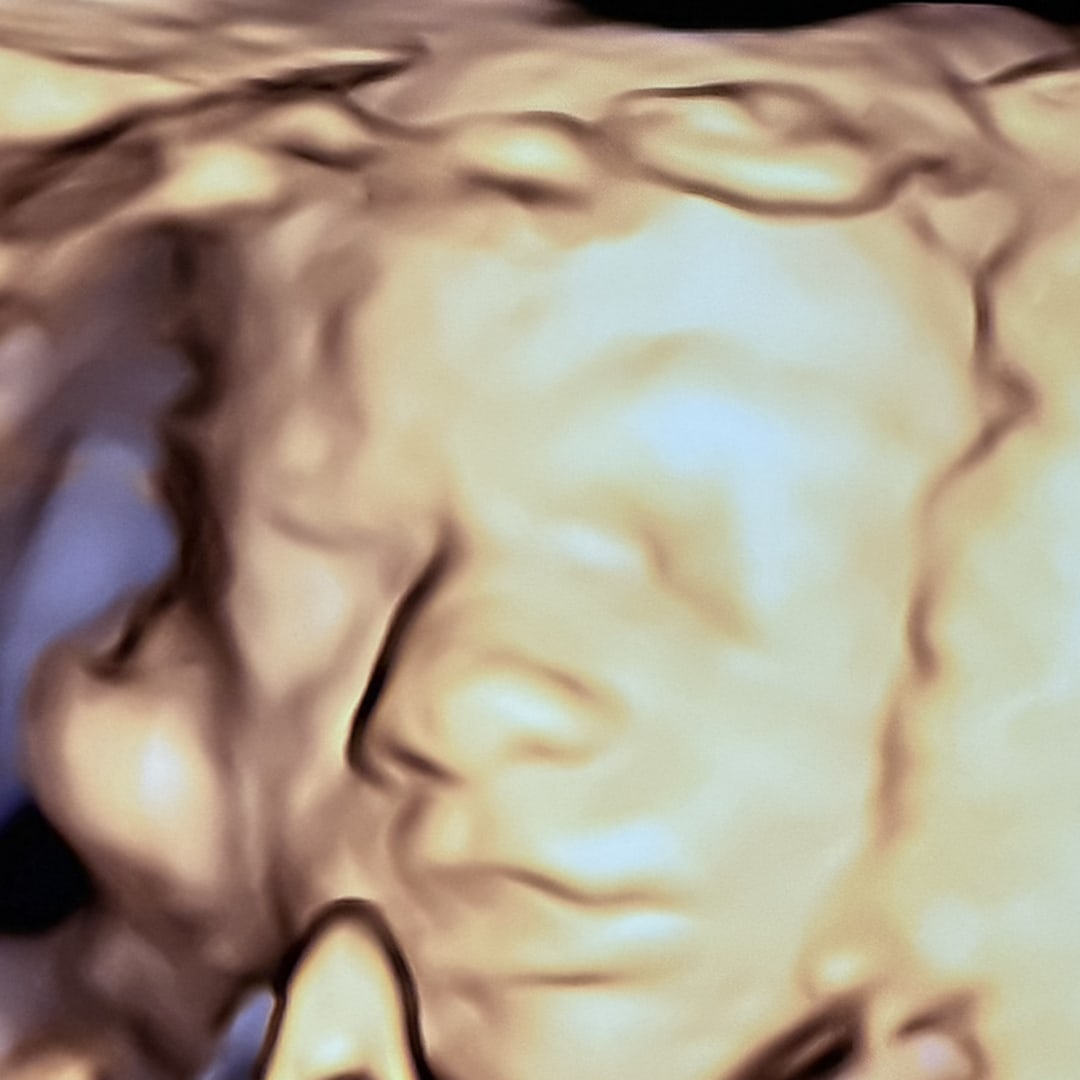 Photo shared by Ally for their Babylist baby registry.