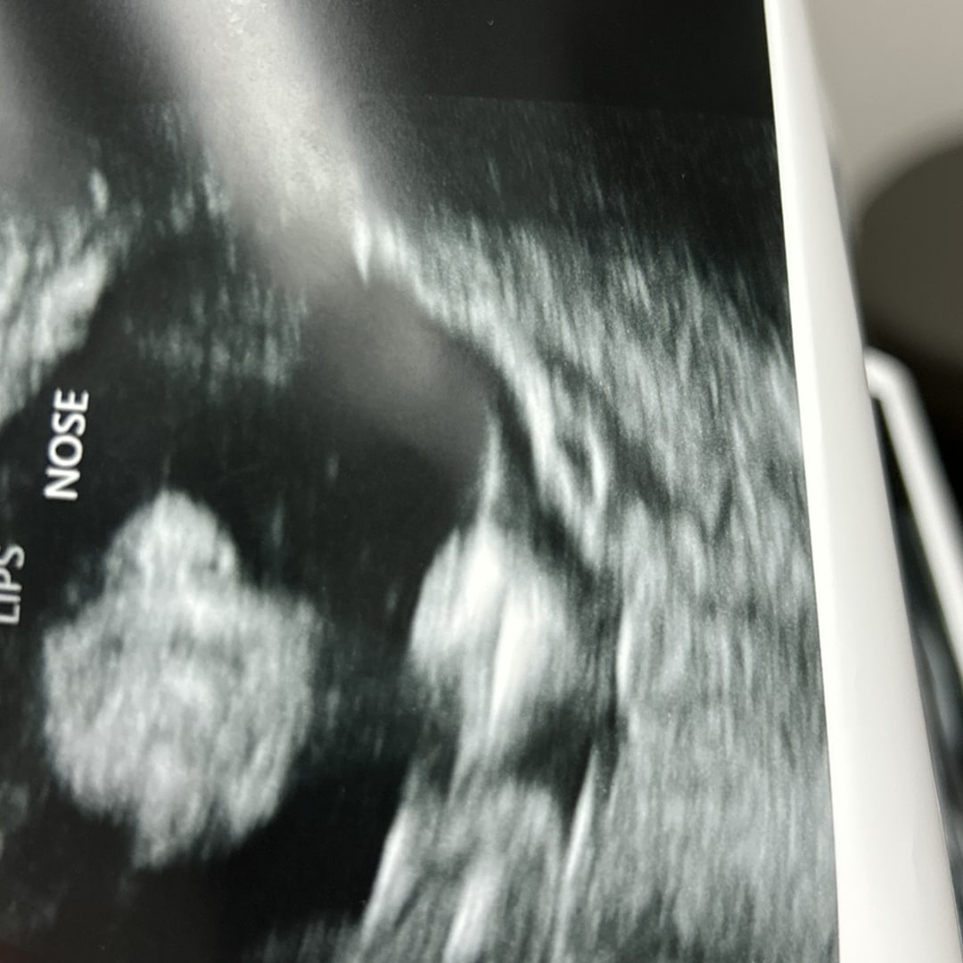 Photo shared by M for their Babylist baby registry.