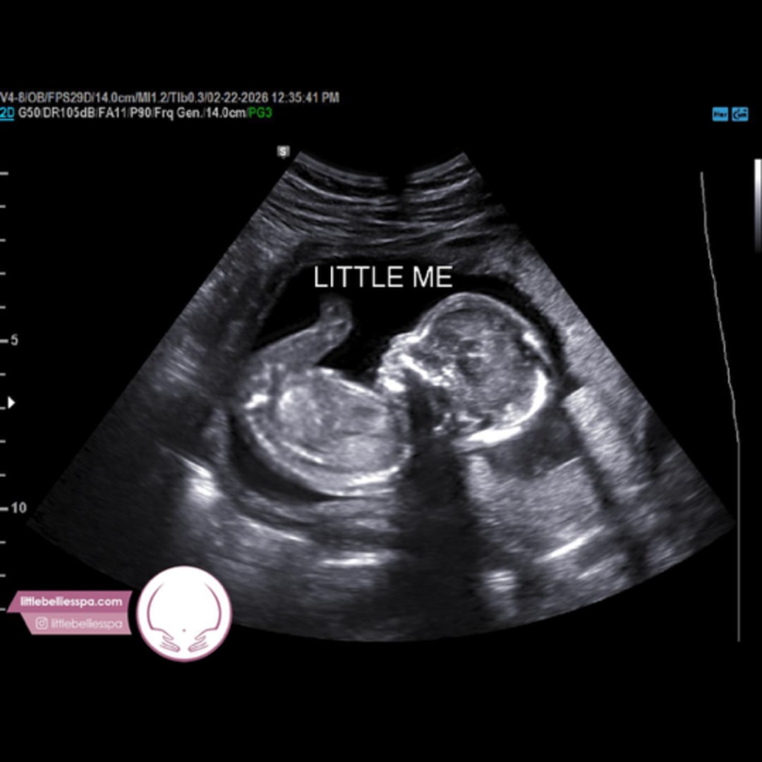 Photo shared by Tamia for their Babylist baby registry.