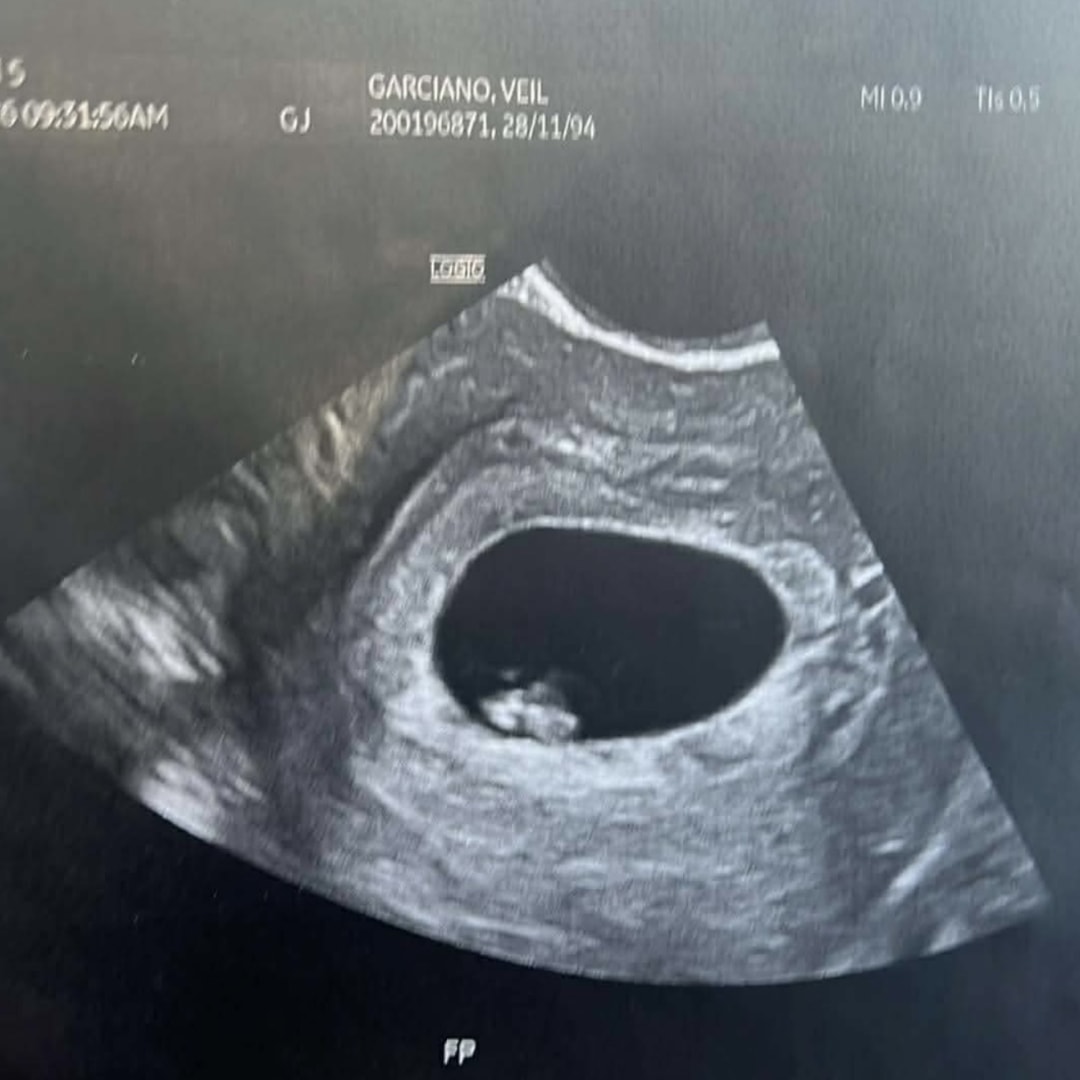 Photo shared by Veil Queen for their Babylist baby registry.