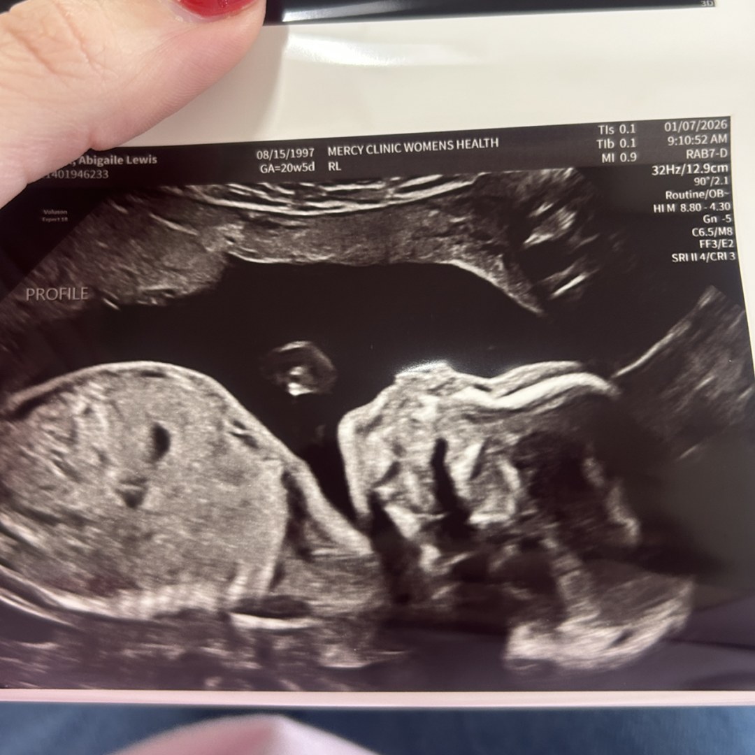 Photo shared by Abbey for their Babylist baby registry.