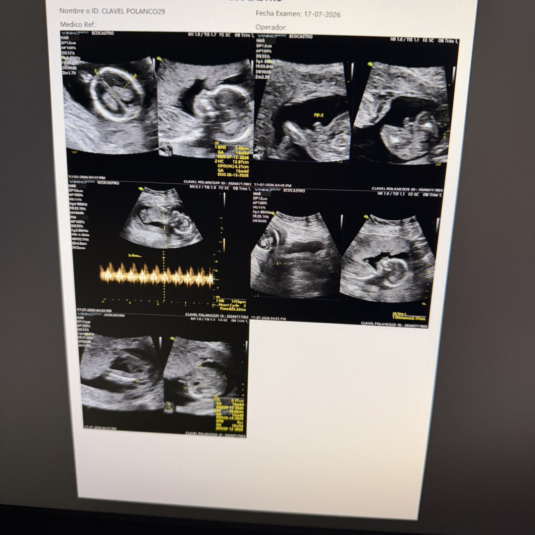 Photo shared by Clavel for their Babylist baby registry.