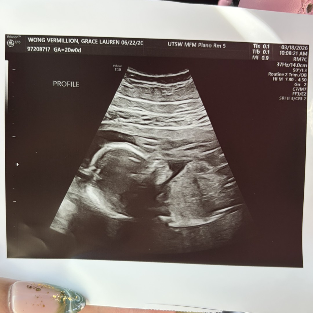 Photo shared by Grace for their Babylist baby registry.